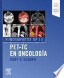 Fundamentos de la Pet-Tc En Oncología