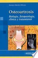 Osteoartrosis