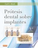 Libro Prótesis dental sobre implantes